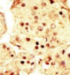 MAP3K9 Antibody (N-term)